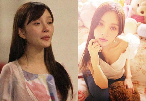 李小璐隆胸过程被揭穿太尴尬!看李小璐如何从a变成e