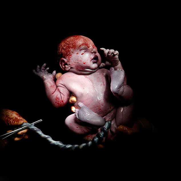 展示了剖腹产的婴儿从母亲体内出生的时刻,这些照片上的婴儿出生都不